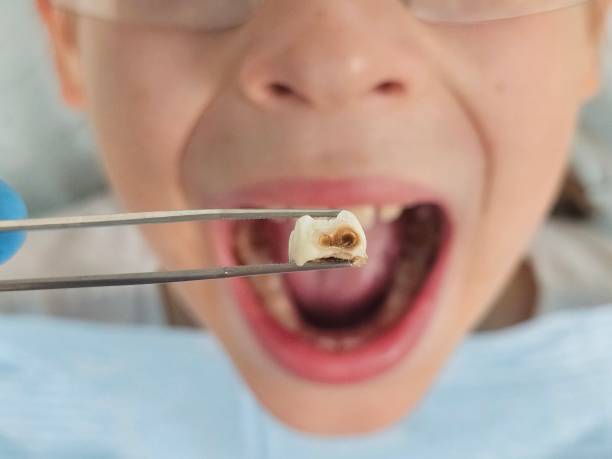 Best Tooth Pain Emergency Relief  in Dolgeville, NY