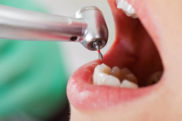 Best Broken Tooth Emergency  in Dolgeville, NY